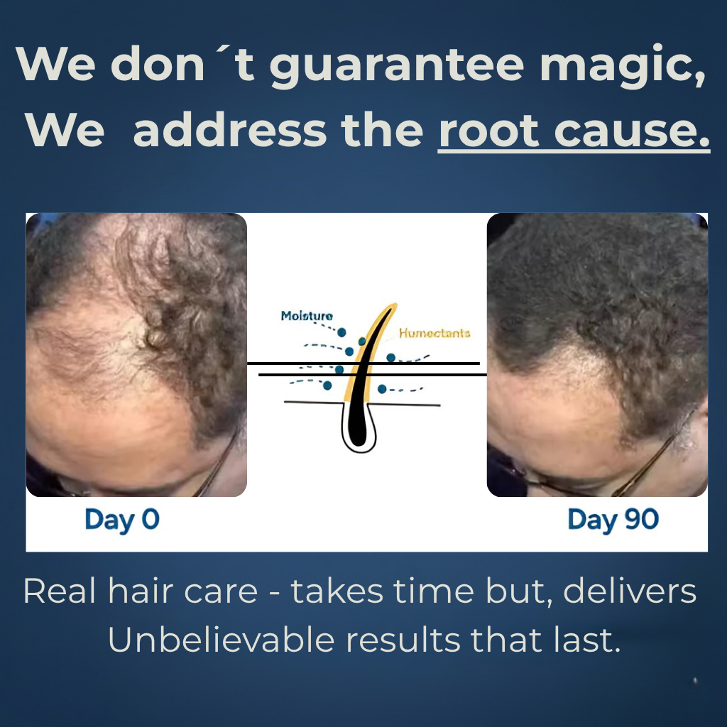 ROVENO - Hair Growth Roll-on