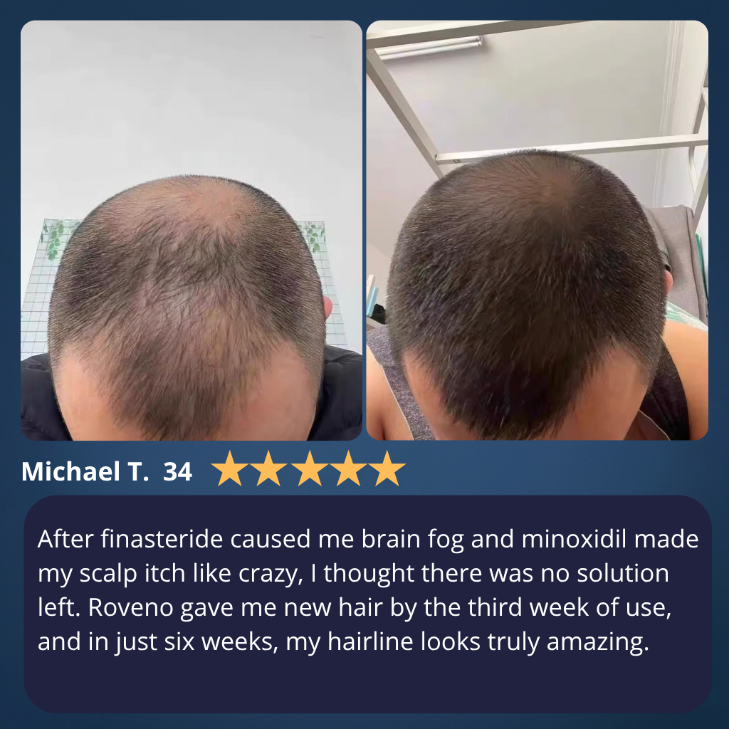 ROVENO - Hair Growth Roll-on