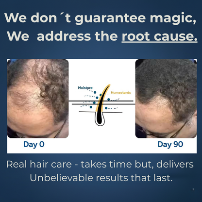 ROVENO - Hair Growth Roll-on